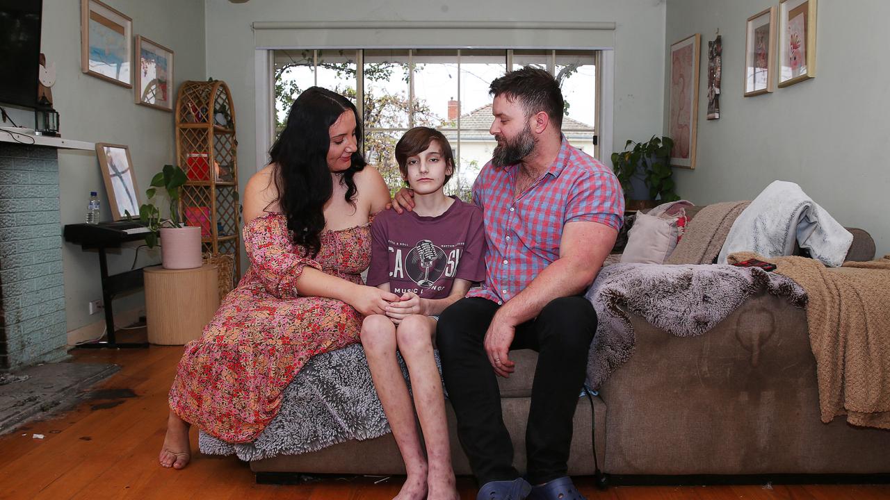 Janelle, Sebastian and Daniel Bridge. Lara teenager Sebastian Bridge is battling a rare health condition caused by mould in his family home that his family discovered by chance in June. Picture: Alan Barber