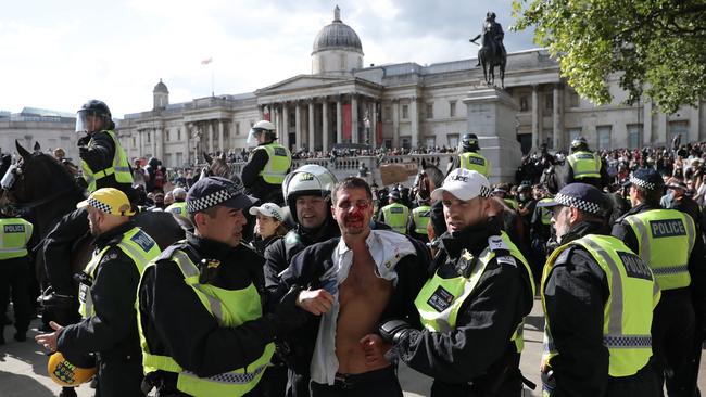 Police lead an injured man as Black Lives Matter and right-wing protesters clash near the National Gallery in London on Saturday. Picture: Getty Images