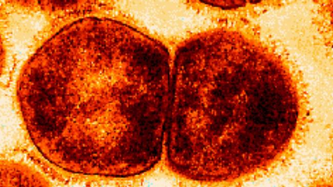 High magnification electron micrograph of an ultra-thin section of a group A streptococcus sibling pair. At this magnification, especially in the cell on the left, the cell wall and cell surface fibrils, consisting primarily of M protein, are well defined. Interdigitaion of these fibrils between neighboring cells of different chains is also in plain view. Strain: C126/21/1; M-type 43. germ bacteria