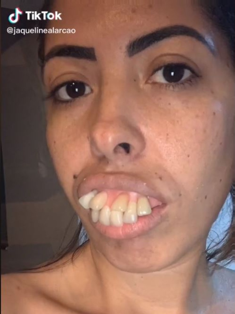 truth about jaqueline alarcãos viral teeth transformation in tiktok