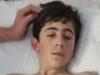Teen boy to undergo surgery after ‘traumatic’ hit-run