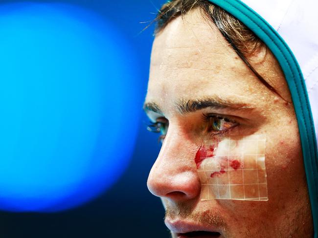 RIO DE JANEIRO, BRAZIL - AUGUST 14: Aidan Roach of Australia is cut on the face during the Australia vs Greece Waterpolo group match at Julio de Lamare Aquatics Centre on August 14, 2016 in Rio de Janeiro, Brazil. (Photo by Adam Pretty/Getty Images)