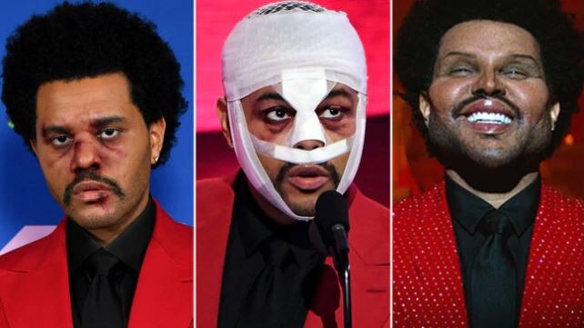 The Weeknd has been shocking the public with his ever-evolving face.