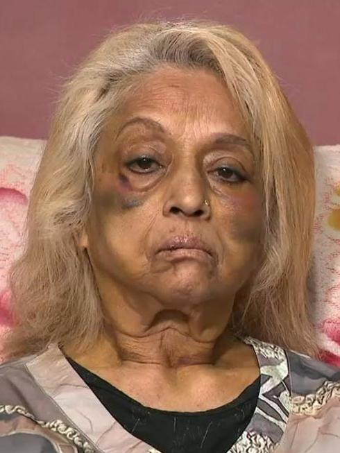 Ninette Simons, the victim of an assault and burglary in the Perth suburb of Girrawheen.