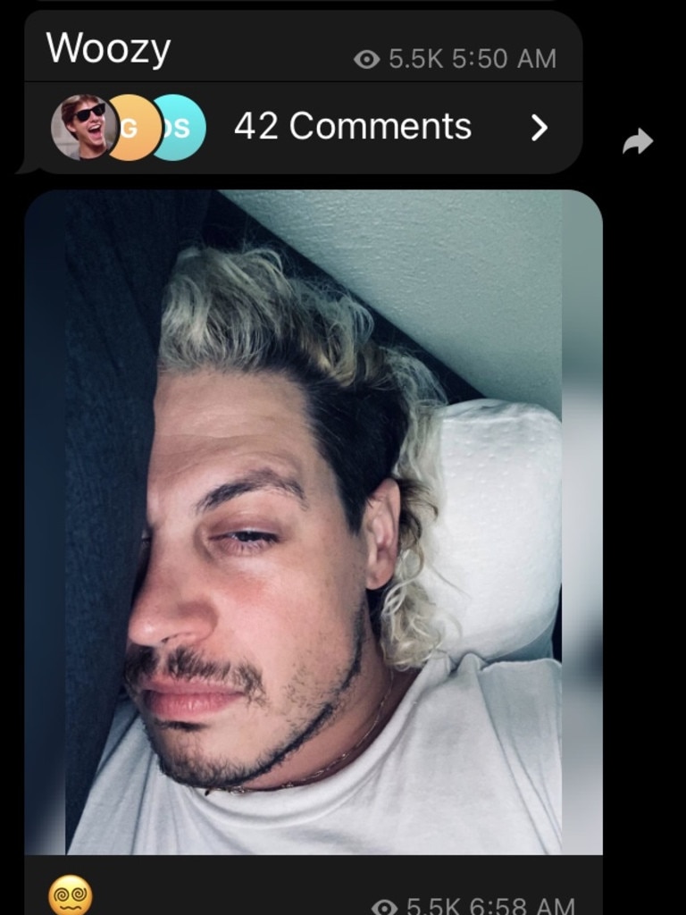 Milo Yiannopoulos shared four images on Telegram over the weekend that suggested he had Covid and had injected himself with Ivermectin. Supplied