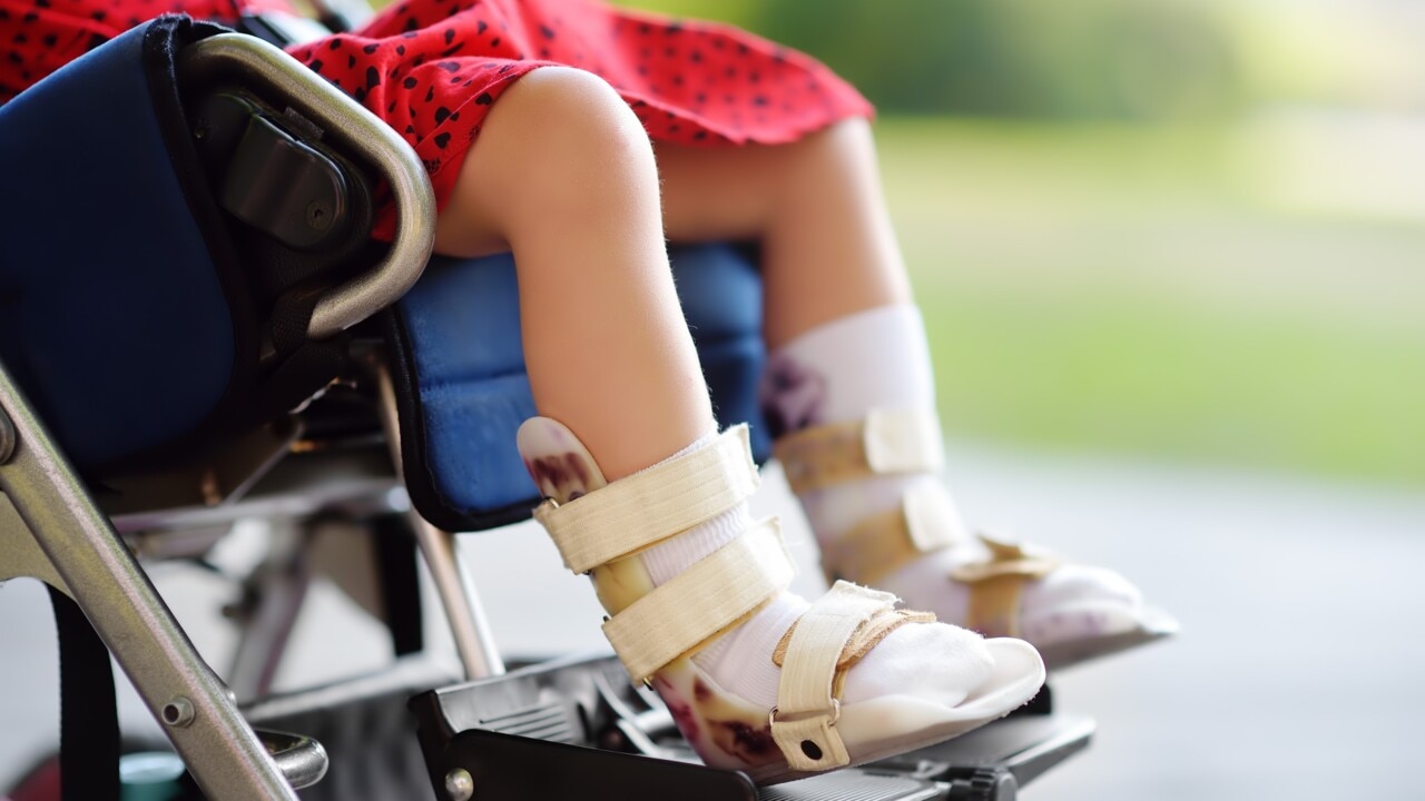 Stem cell treatment could be 'a game changer' for kids with Cerebral Palsy