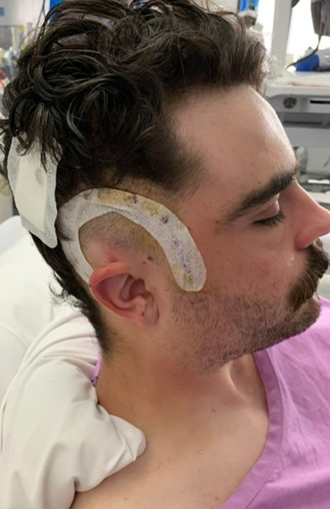 Michael Maloney in hospital after he was diagnosed with grade four brain cancer. Photo: Supplied