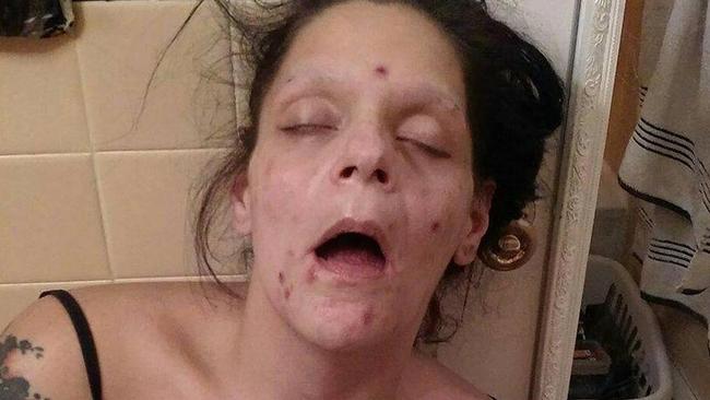 Melissa Lee Matos has shared shocking pictures of herself as a heroin addict. Picture: Facebook