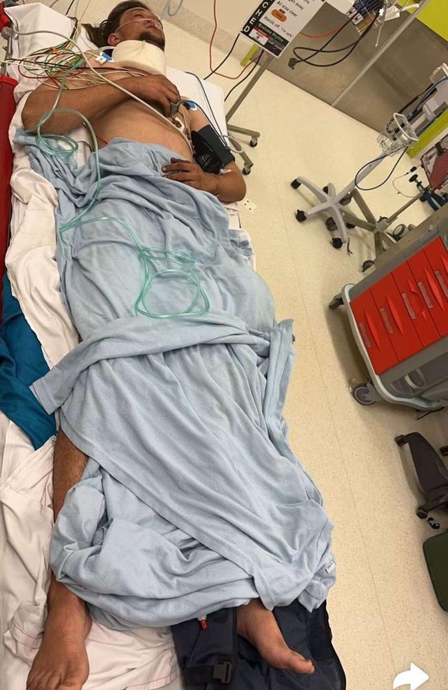 Teen worker Ethan Avenell was partially crushed by a mine truck tyre part on August 16, 2024 at the Peabody-owned Moorvale Mine in Coppabella, Queensland. He suffered a broken ankle, and two breaks to his arm. Picture: Ethan Avenell