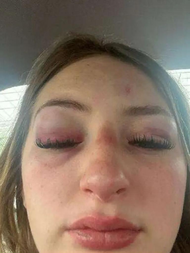 Brooke Serbeck seen with injuries on her face. Picture: Supplied
