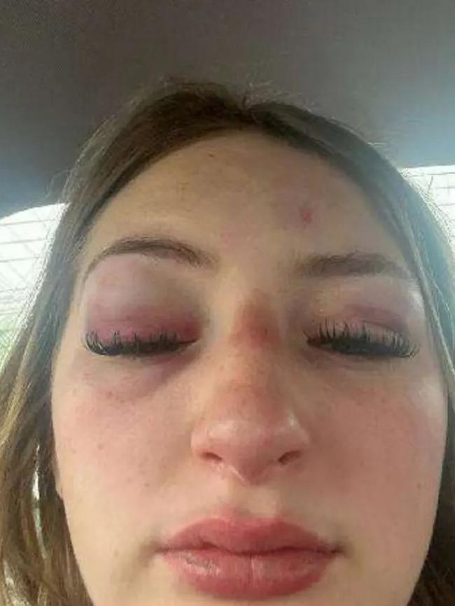 Brooke Serbeck seen with injuries on her face. Picture: Supplied