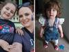 Why little girl, 7, has had 40 procedures