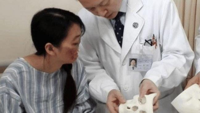 Jin Qi lost her nose and lips as a child, and is about to grow a new pair thanks to facial reconstruction surgery in China. Picture: Xinhua