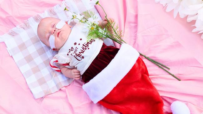 Christmas miracle as 500g baby beats the odds to make it home