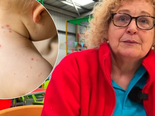 ‘Selfish’: Parents host secret Chickenpox Party at play centre