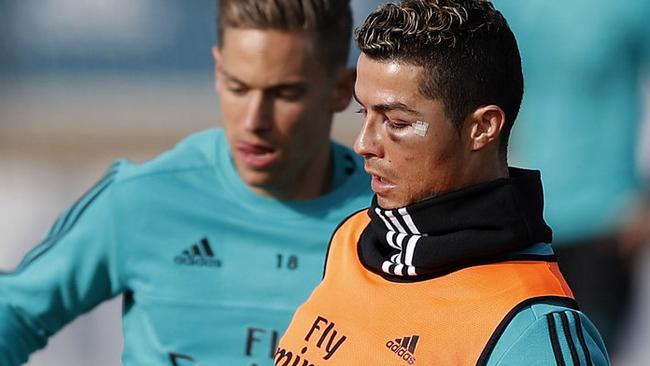 Cristiano Ronaldo's injury at training