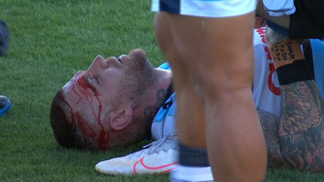 Josh Dugan left the field for Head Injury Assessment in his side's match against the Cowboys