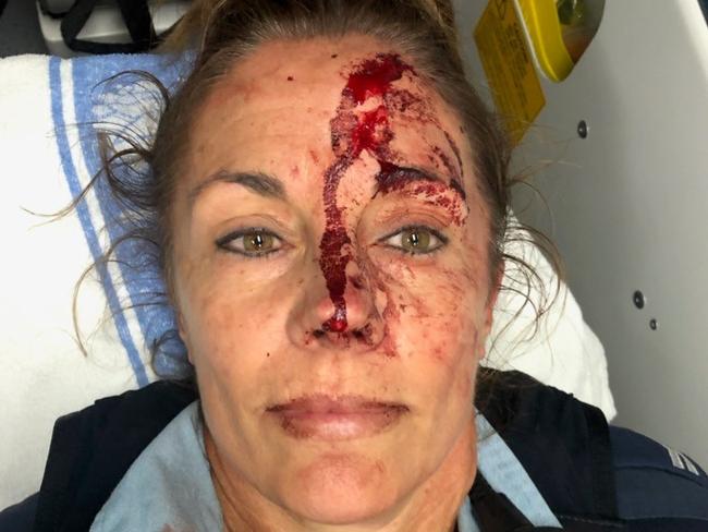 The 47-year-old Senior Constable suffered injuries when she was assaulted by Sanders at Halekulani. Picture: NSW Police