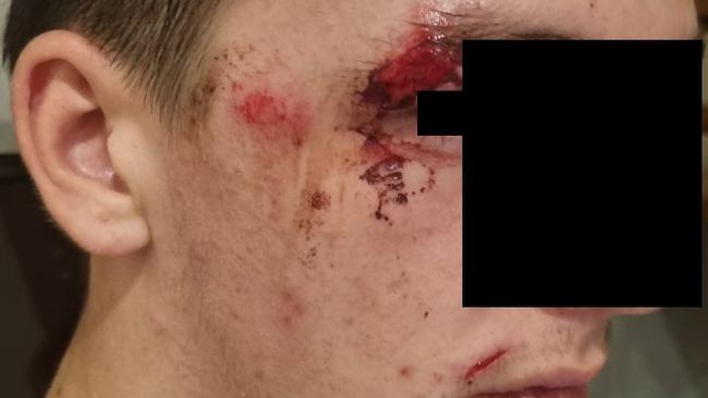 A Currumbin Waters mum is desperately seeking further information from the community after her son was allegedly knocked off his bike in a suspected hit-run on Currumbin Creek Rd on the evening of January 24, 2025. Picture: Supplied