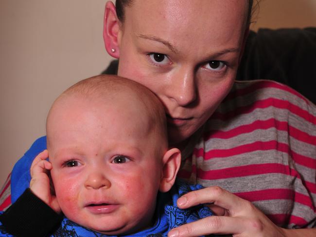 In Victoria, Australia, Sunbury resident Leanne McKenzie claims her son Tyler contracted hand, foot and mouth disease from a Sunbury kinder. After intense medical treatment her son is finally recovering at home.