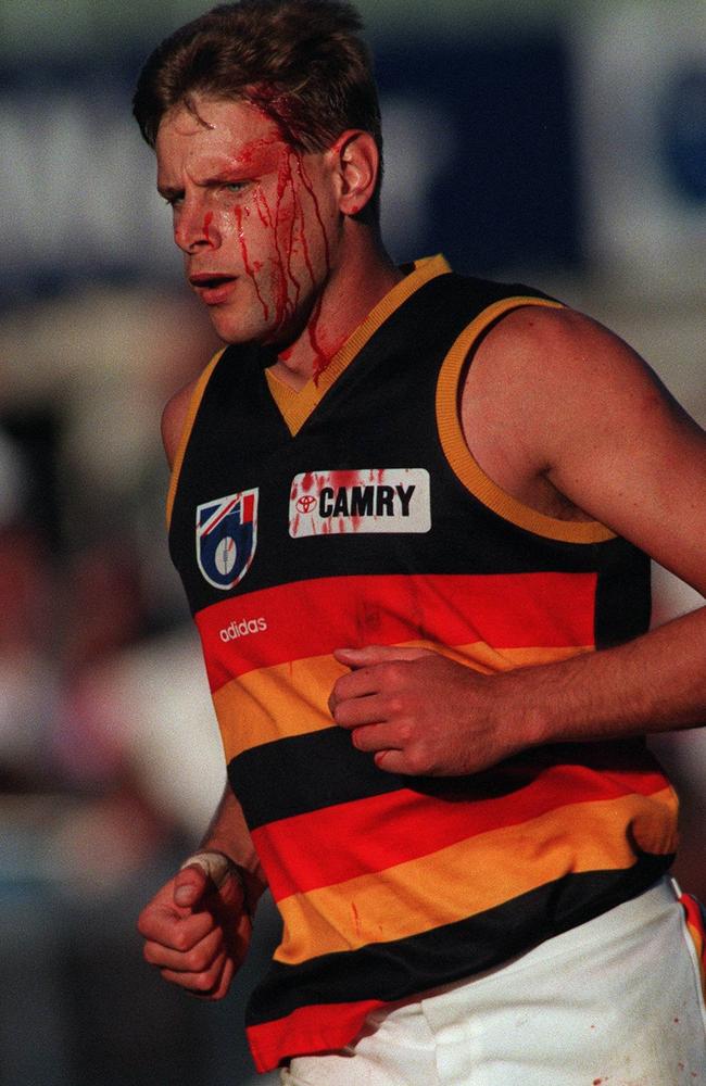 Barry Standfield spilling blood for Adelaide.