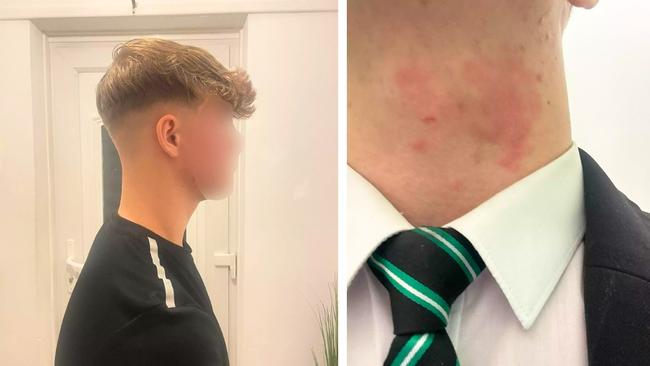 His family said the haircut helped keep his head cool and avoided his eczema from flaring up. Credit: SWNS