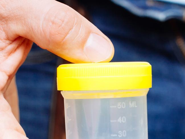 Man Holding in Hands Container With Sperm. Sperm donor. Health concept Picture: ISTOCK