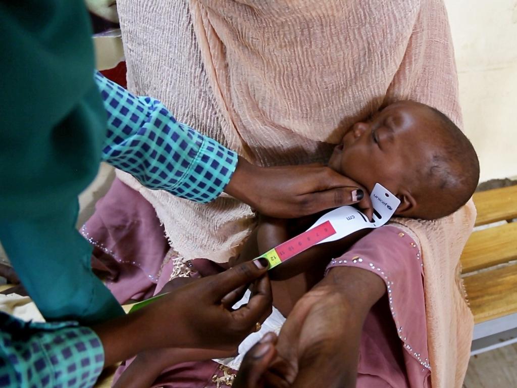 A health worker at Damazine Children's hospital, Blue Nile state screens six-month-old Baraa for malnutrition during a visit to the hospital. Picture: UNICEF