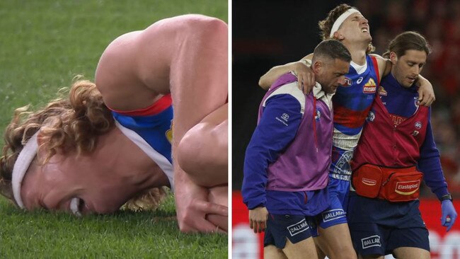 Aaron Naughton injured against the Swans. Photos: Fox Sports/Michael Klein