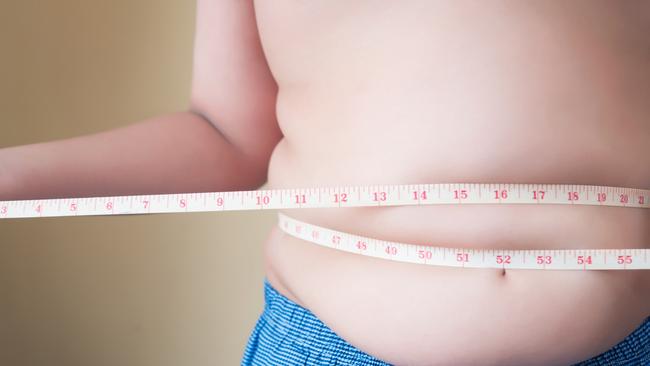 Childhood obesity is a ‘whole of society issue’, according to the co-author of a new study. Picture: istock