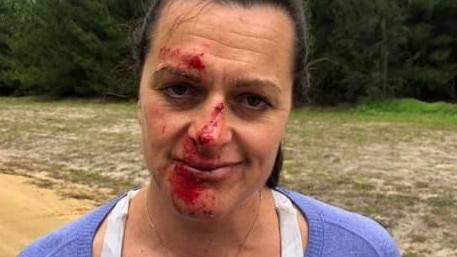 Joanna Mactier after the attack.