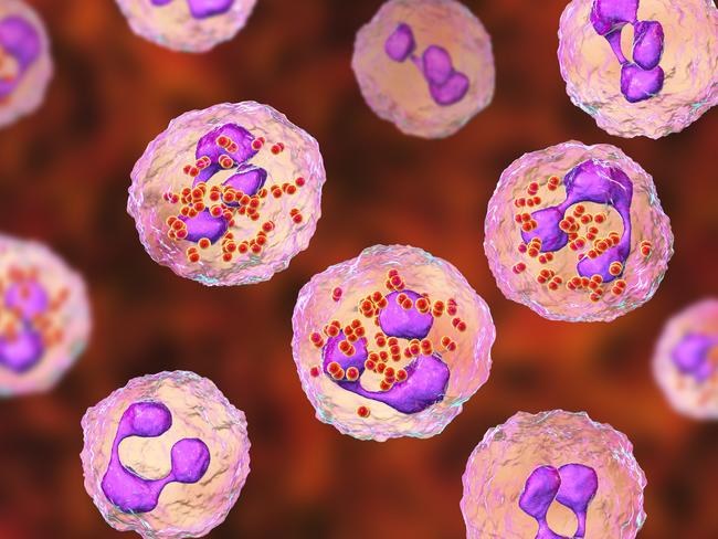 Meningococcal meningitis, cerebrospinal fluid smear containing neutrophils with and without bacteria Neisseria meningitidis, 3D illustration