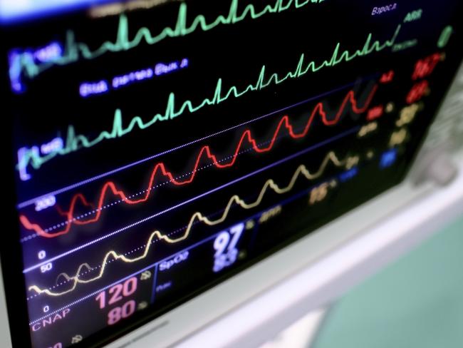 The new test will help predict those people in need of more aggressive treatment for heart disease.