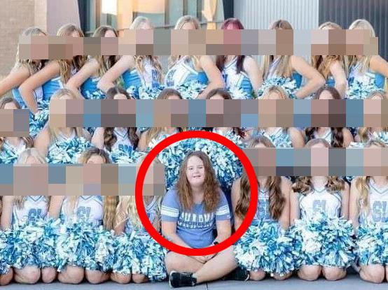 School edits Down syndrome teen from pic