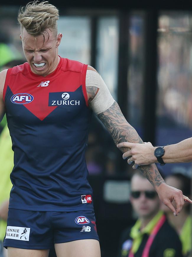 James Harmes injured his finger. Picture: Michael Klein