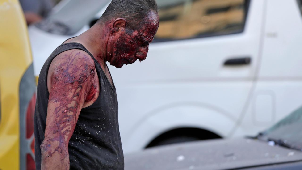 A wounded man walking near the scene of the explosion. Picutre: Anwar Amro/AFP