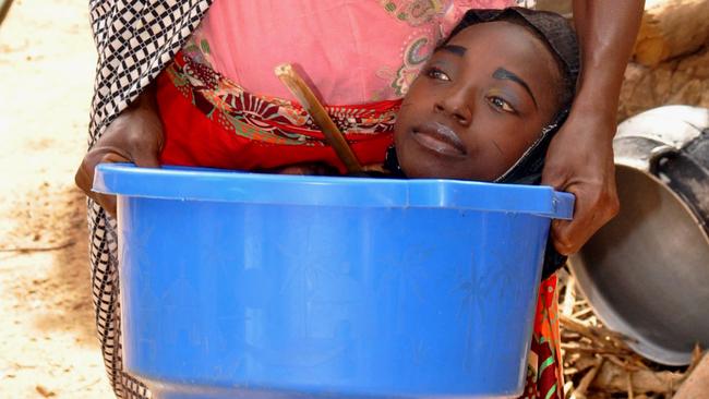 Rahma Haruna was born without limbs and lives in a bowl | Video