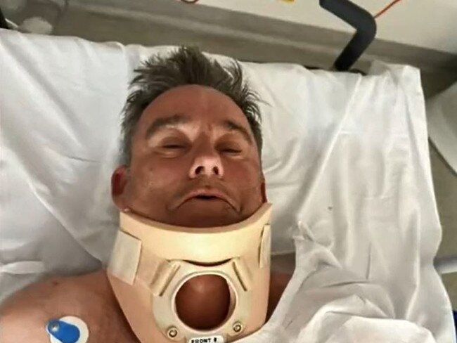 Cyclist Mark Vander says the incident makes him ‘angry all the time’. Picture: 9 News