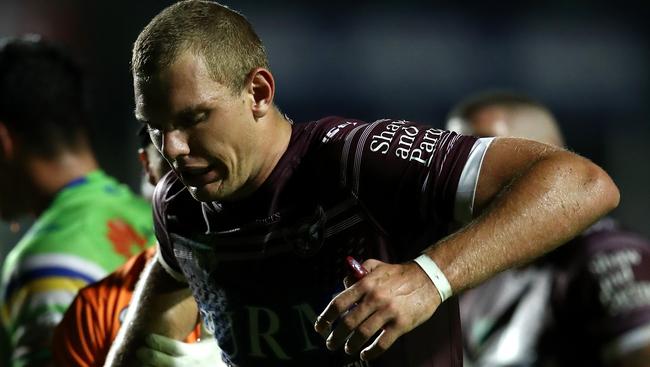 Tom Trbojevic was hurt in the Sea Eagles’ win over Canberra.