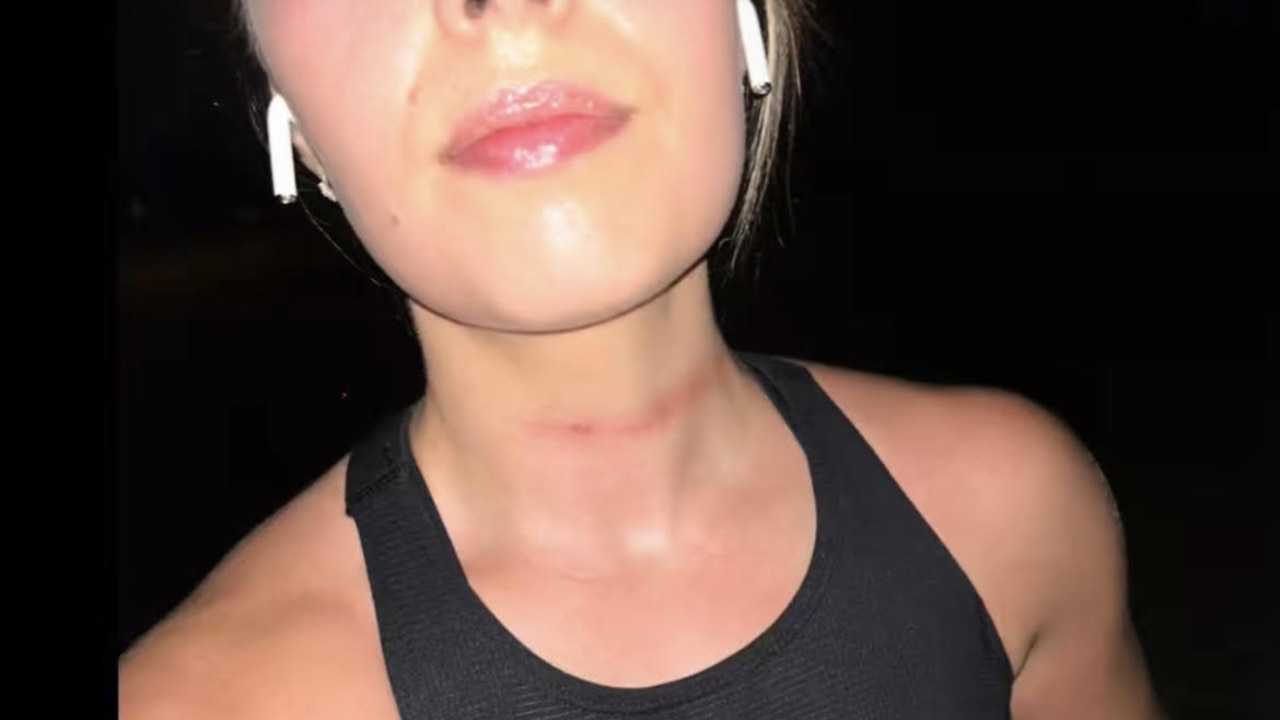 Reality star and F45 trainer, Leesh Cunningham was left with lacerations to her neck after someone tied a piece of fishing wire to two trees along a running track. Picture: Tik Tok