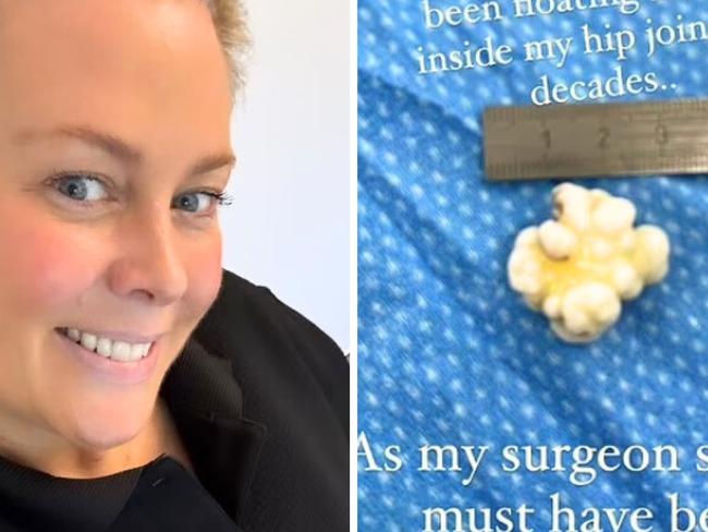 Samantha Armytage recently had surgery. Picture: Instagram.