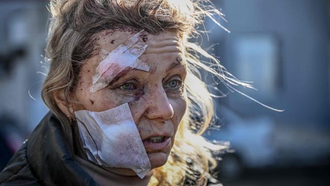 A wounded woman stands outside a hospital after the bombing of the eastern Ukraine town of Chuguiv on February 24, 2022, (Photo by Aris Messinis / AFP)