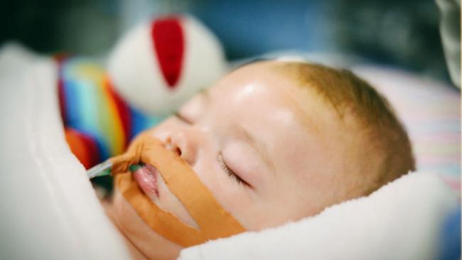 Bobby Webber pictured in hospital after being attacked by his uncle when he was seven-months-old.