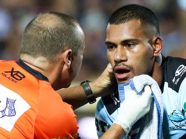 Sione Katoa of the Sharks left the field with a suspected broken jaw during the Round 1 NRL match between the North Queensland Cowboys and the Cronulla-Sutherland Sharks at 1300SMILES Stadium in Townsville, Friday, March 9, 2018. (AAP Image/Michael Chambers) NO ARCHIVING, EDITORIAL USE ONLY