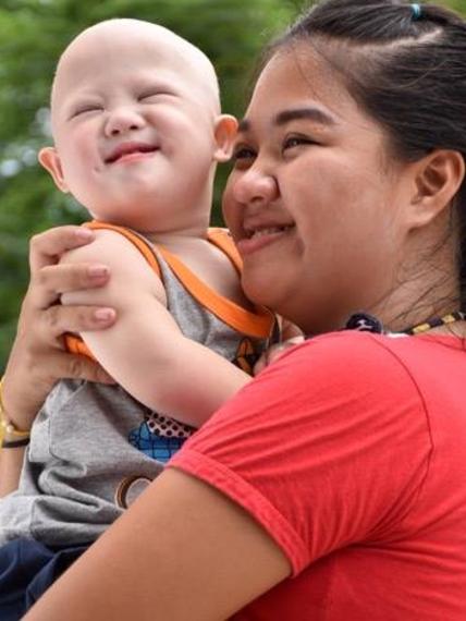 Baby Gammy was abandoned in Thailand and has since made a remarkable recovery. (Pic: Facebook)