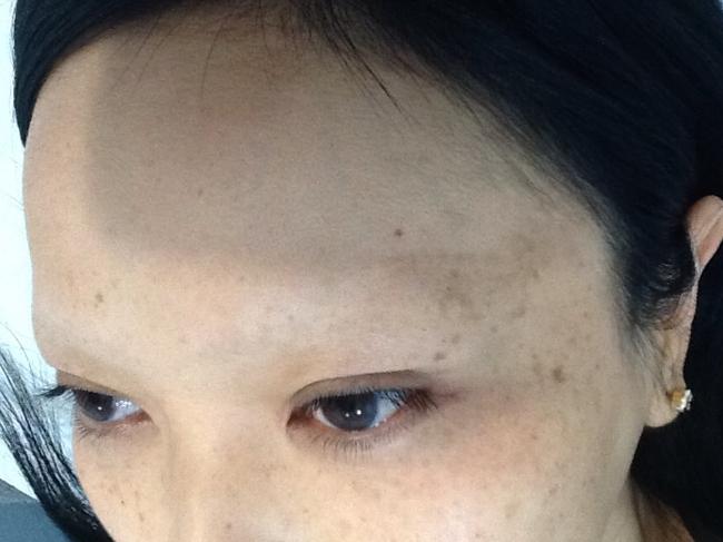 Kym's eyebrows after the successful laser tattoo removal.