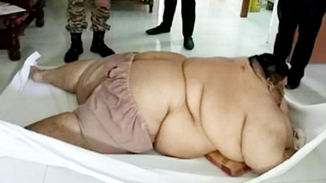 Sia Chie Herng, from Malaysia, lies in bed after being immobile from eating too much. Picture: Snapper.