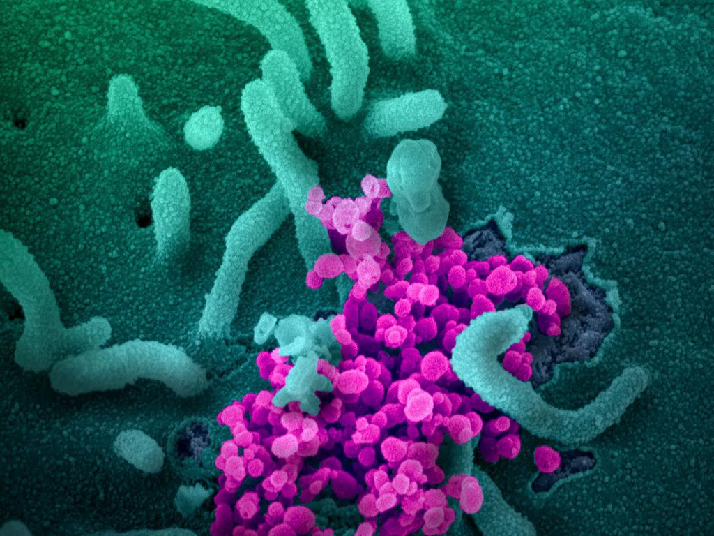 A scanning electron microscope image of SARS-CoV-2 (round magenta objects) emerging from the surface of cells cultured in the lab, SARS-CoV-2, also known as 2019-nCoV, is the virus that causes COVID-19.