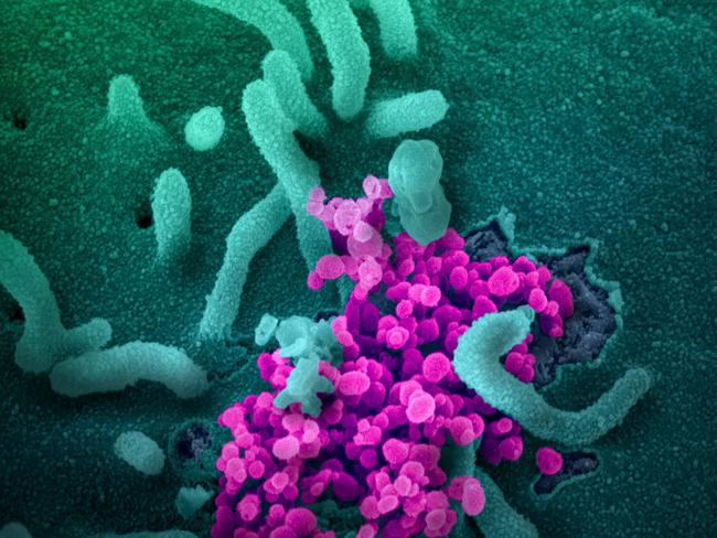 A scanning electron microscope image of SARS-CoV-2 (round magenta objects) emerging from the surface of cells cultured in the lab, SARS-CoV-2, also known as 2019-nCoV, is the virus that causes COVID-19.