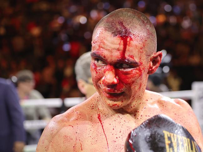 Tim Tszyu was blinded in his fight with Sebastian Fundora. Picture: Getty Images